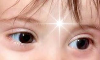 योग कमेंटरी | रूहानी नैनौं का श्रूंगार | Spiritual Decoration of Cool Eyes image